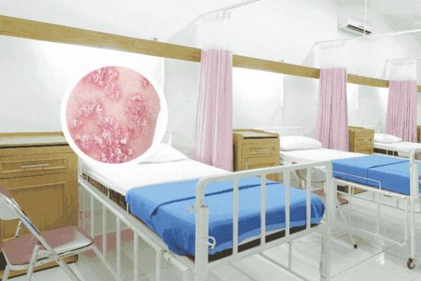 长春哪里的医院看银屑病好-长春治疗银屑病哪个医院好