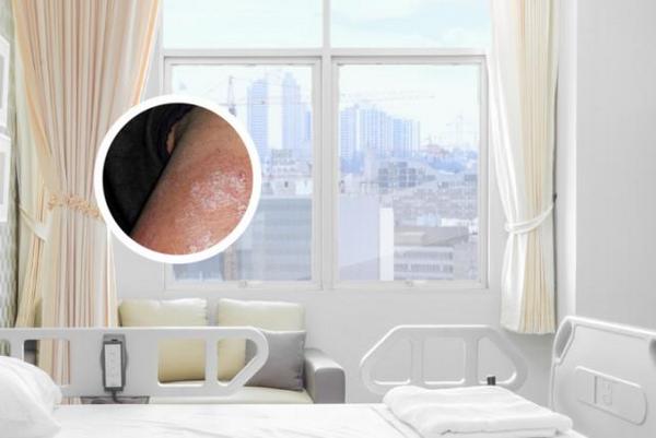 长春哪所医院治银屑病效果好-长春银屑病在哪看好