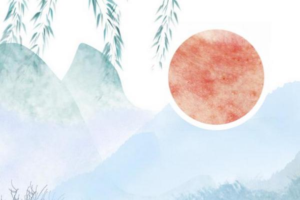 长春博润医院是不是正规医院-长春什么医院看银屑病可以