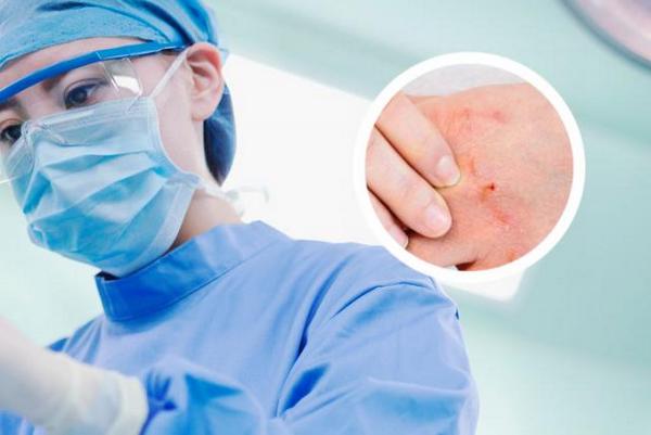 长春咨询博润看银-长春专业银屑病医院哪所好