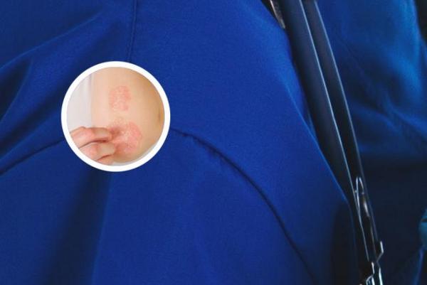 长春治银_博润显著-长春银屑病去哪儿治好