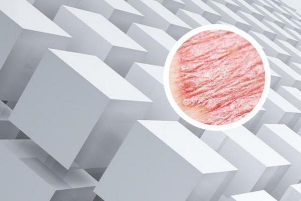 长春银屑病专业医院的地址-长春看银屑病哪家好