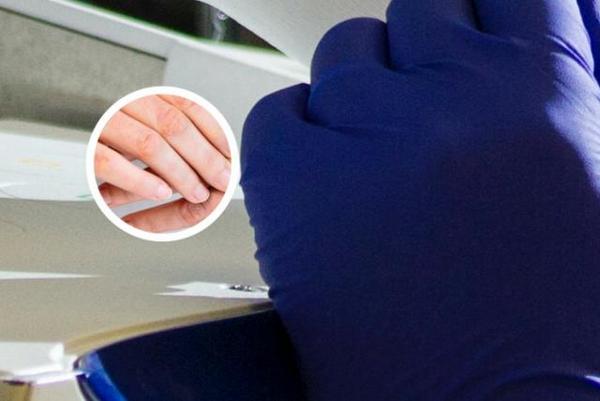 长春银屑病治疗好的专业医院-长春哪儿有治疗银屑病的